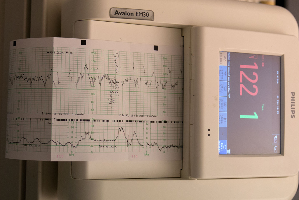 En haut, le coeur de Virgile, encore au chaud dans le ventre de sa maman. En bas, les contractions.